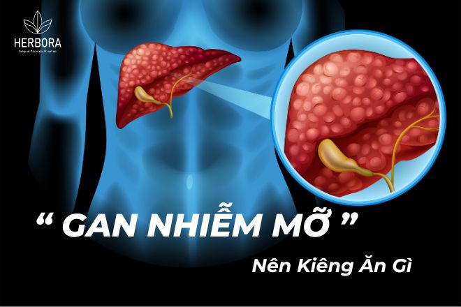 Gan nhiễm mỡ nên kiêng gì